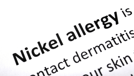 nickel allergi